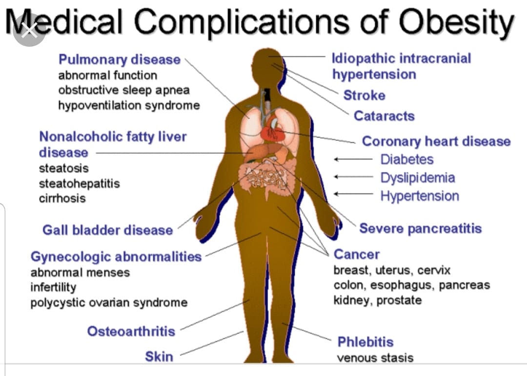 Kencing Manis, Obesiti, Buncit: Membongkar Rantaian Senyap dan Jalan Pemulihannya