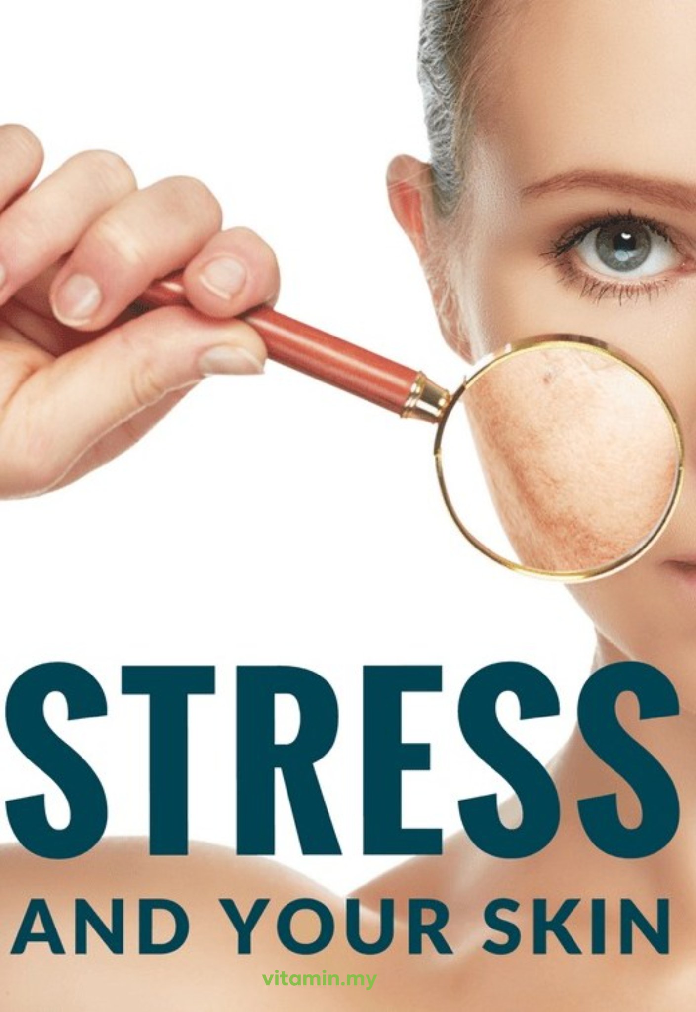 Kesan Stress Terhadap Kulit – Kenapa Wajah Semakin Kusam Bila Fikiran Serabut?