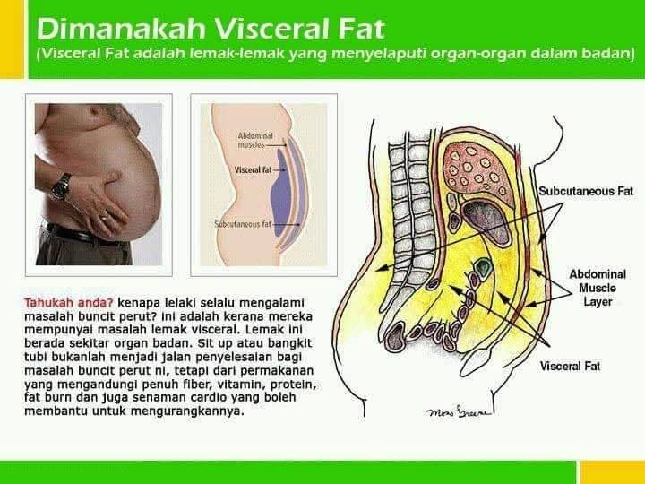 Perut Buncit Lemak Visceral : Ancaman Senyap Kesihatan Moden