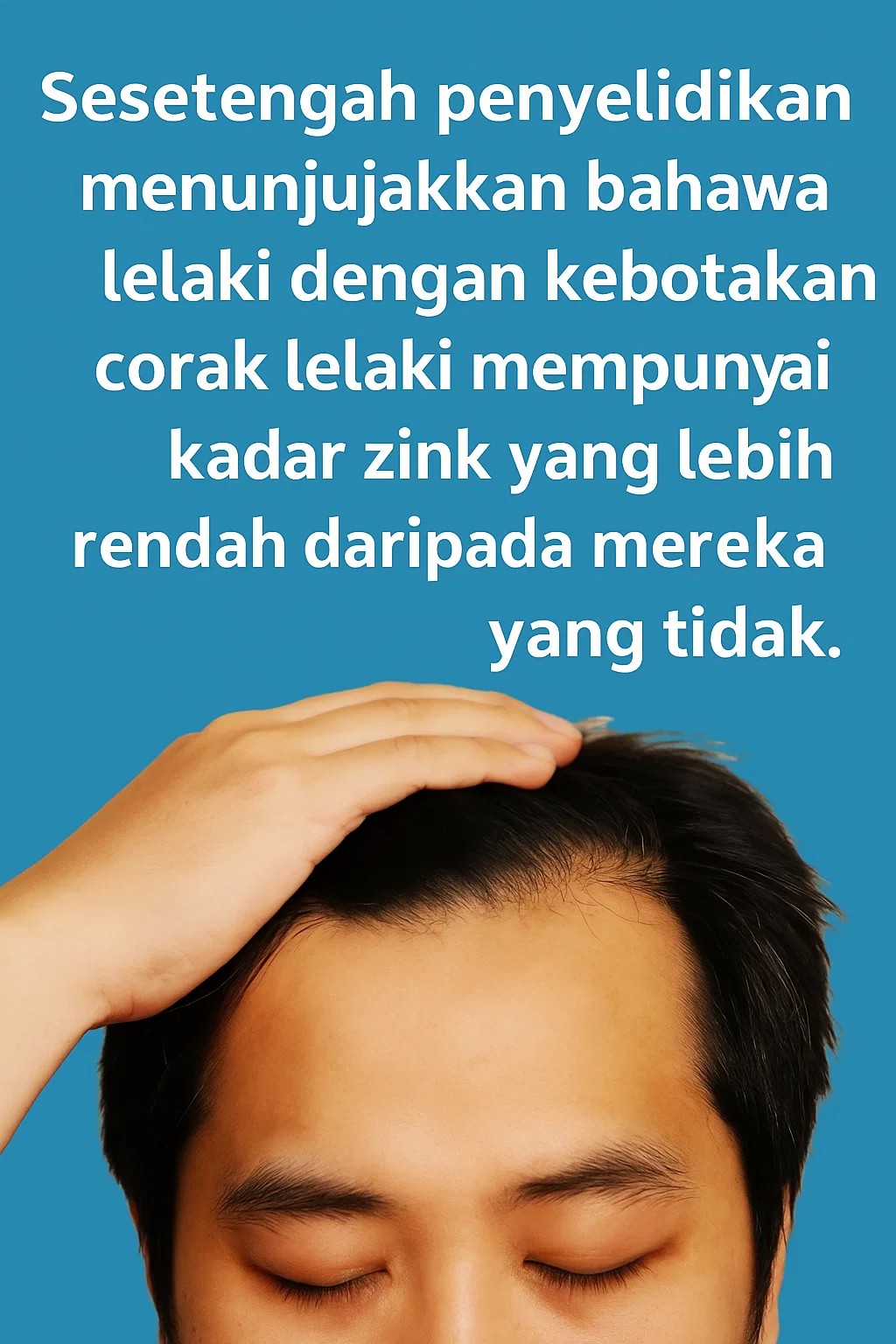 zink lelaki jadi botak