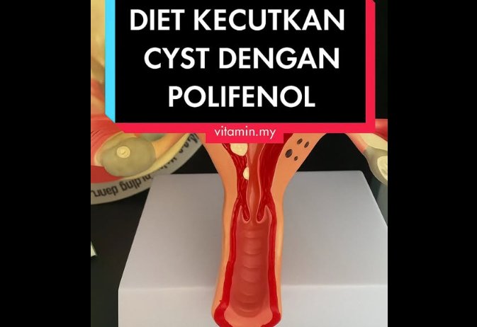 Kecutkan Cyst Secara Semulajadi Dengan Diet Real Food